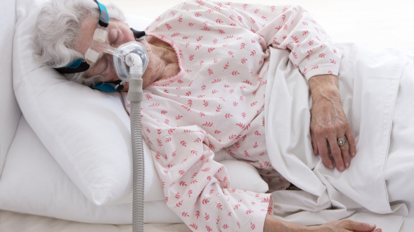 Kvinnor och män kan drabbas olika av sömnapné